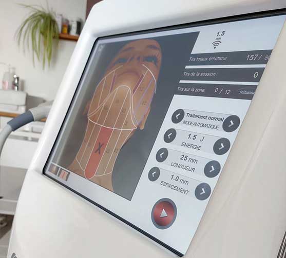 Écran d'un appareil de soin